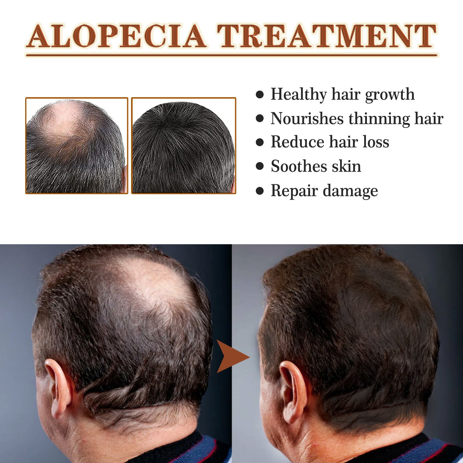 Dry And Manic Hair Growth Care Essential Oil