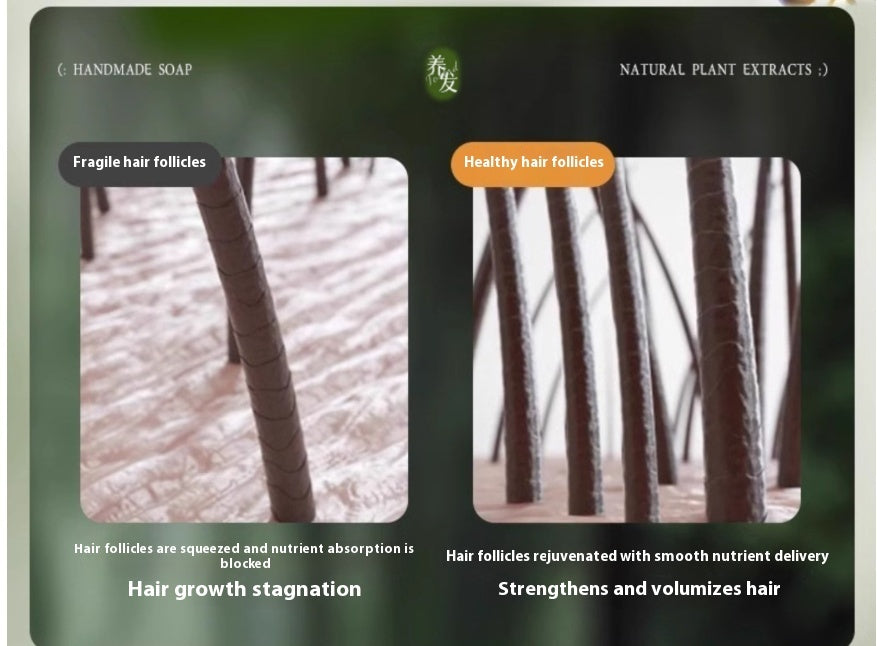 Oil Control And Dandruff Removal Soap